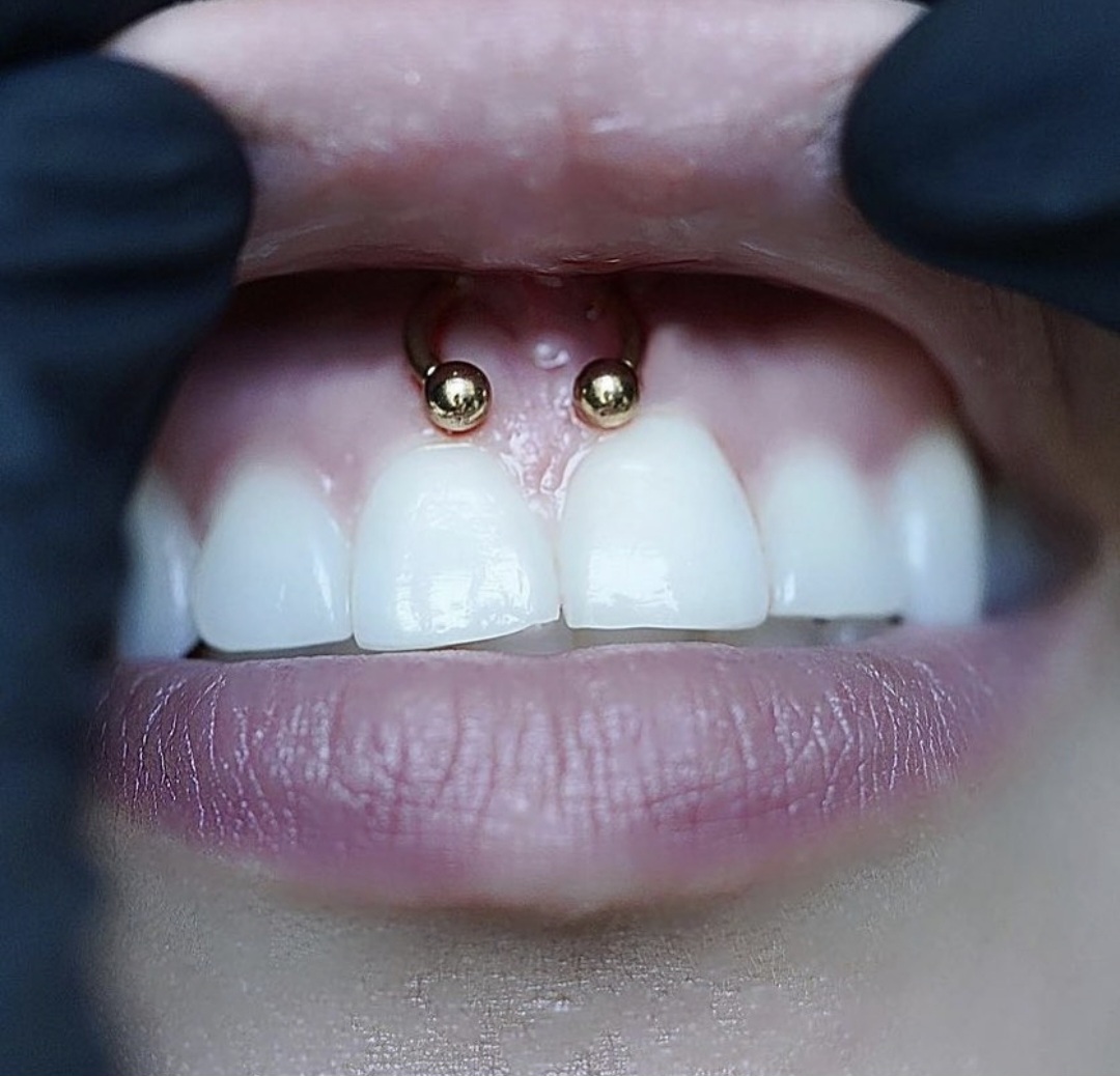 Smiley piercing